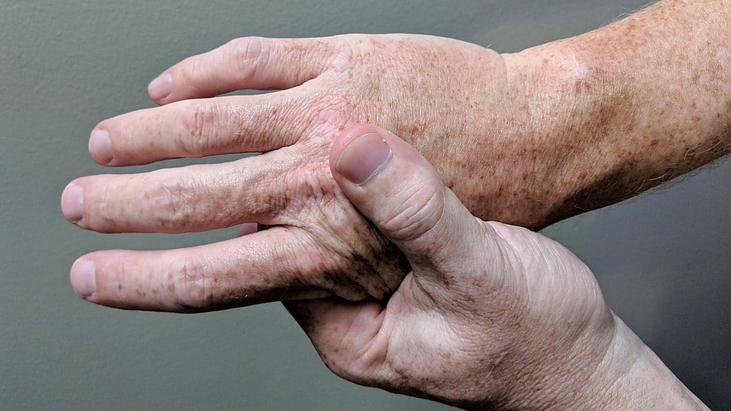leddsmerter i fingrene leddsmerter i fingrene