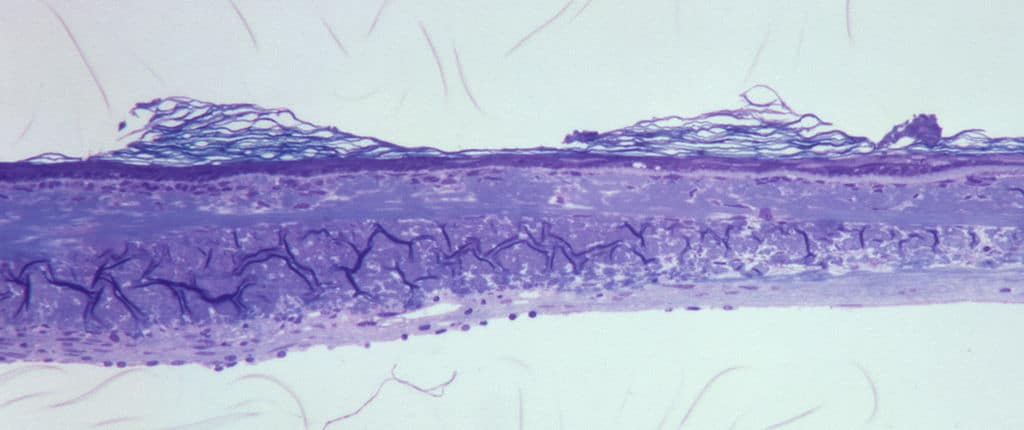 tympanisk membran keratin-hårlapper tympanisk membran keratin-hårlapper